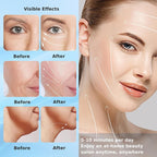 Appareil de lifting visage Abay 7 couleurs pour raffermir et lisser la peau