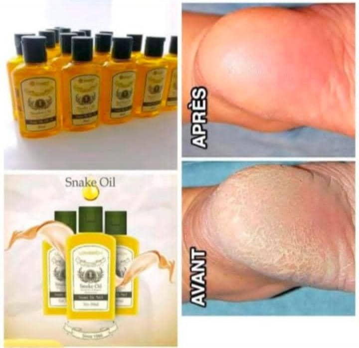 Huile de Serpent & Gel de Serpent Longrich – Anti‑douleur, Réparateur & 2‑en‑1