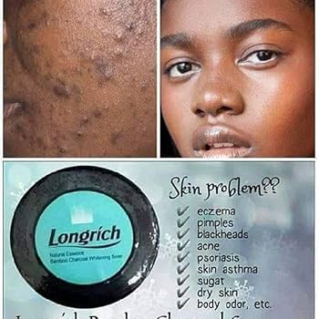 Savon Longrich Bamboo Charcoal – Anti‑acné, Anti‑taches & Purifiant naturel